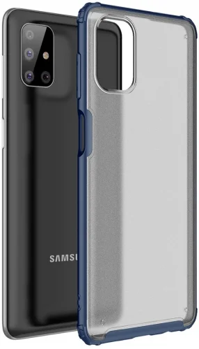 Samsung Galaxy M51 Kılıf Volks Serisi Kenarları Silikon Arkası Şeffaf Sert Kapak - Lacivert